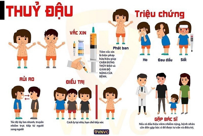 Số ca mắc thủy đậu tăng cao - Bộ Y tế nêu biện pháp